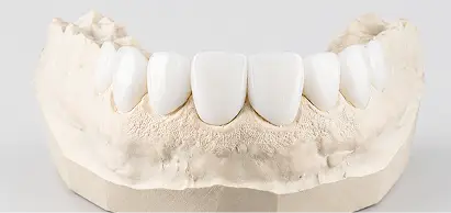 Dental Crowns