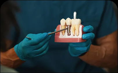 What Is A Dental Implant?