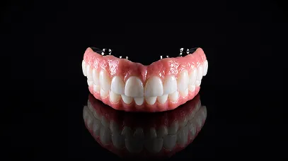 Full Mouth Fixed Implant Solutions