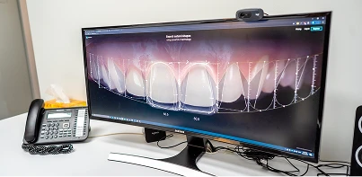 Personalised 3D Implant Planning