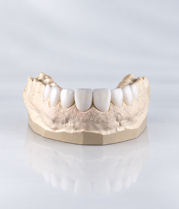 crown-filling